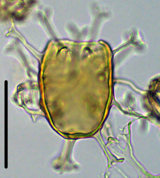 Hystrichosphaeridium tubiferum 2 Htub27X23334295b.jpg